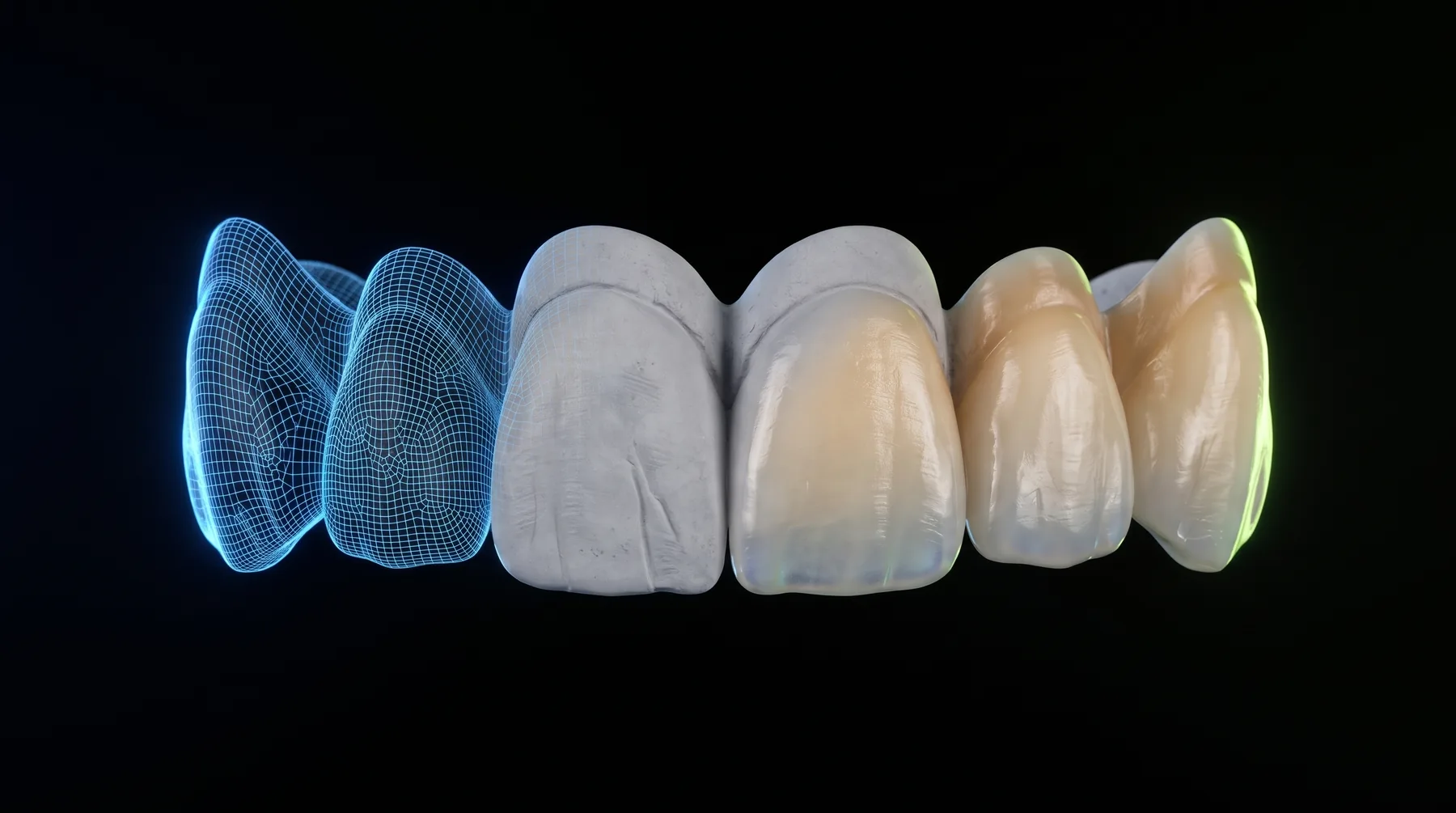 Arcadă dentară trecând de la scanarea digitală la modelul din gips și la lucrarea ceramică finală
